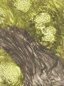 ETNA. Mennesket er en vulkan XI